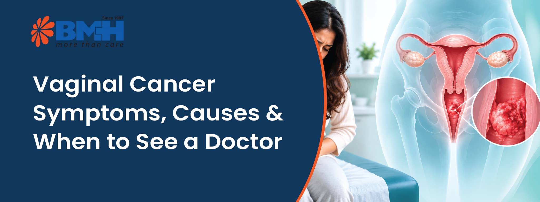  Vaginal Cancer01